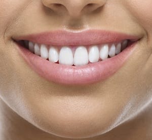 Consultation and Teeth Whitening with Optional Clean, Scale and Polish at Cosmetic Care Medical Center* Beauty Care Shop Online at Dubai Offers