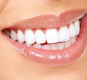 Dental Check-Up, Cleaning, Scale and Polish, Teeth Whitening at Dr William’s Dental Center* Beauty Care Shop Online at Dubai Offers