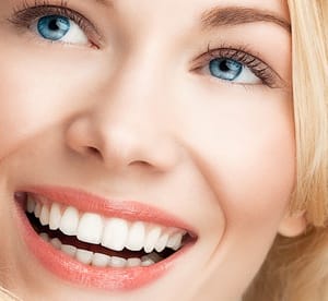 Up to 14 Veneers with Dental Consultation, Scale and Polish at Levantine Dental Clinic* Beauty Care Shop Online at Dubai Offers