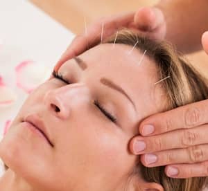 Up to Five Acupuncture Sessions with Consultation from Acupuncture Chinese Center at One to One Hotel* Beauty Care Shop Online at Dubai Offers