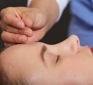 Up to Five Acupuncture Sessions with Consultation from One to One Chinese Acupuncture Center Beauty Care Shop Online at Dubai Offers